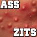 ass zits with nasty whiteheads.
